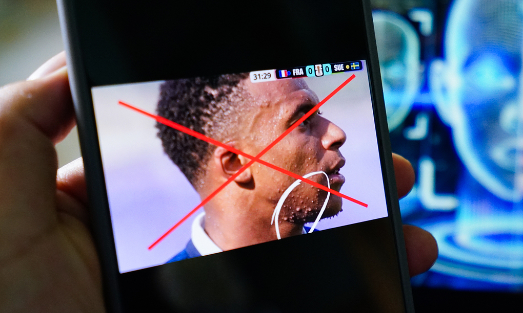 Ảnh Kylian Mbappé mọc mụn lạ được xác thực giả mạo. Ảnh: X/DR